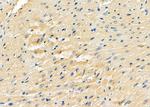 EVL Polyclonal Antibody