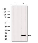 PLA2 Polyclonal Antibody