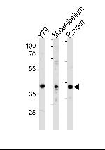 NeuroD1 Polyclonal Antibody
