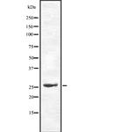 Cdc34 Antibody in Western Blot (WB)