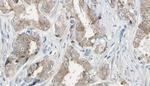 Phospho-MEKK1 (Thr1402) Antibody in Immunohistochemistry (Paraffin) (IHC (P))