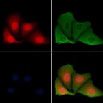 HMGN1 Polyclonal Antibody