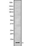 HMGN1 Antibody in Western Blot (WB)