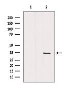 SLC25A5 Polyclonal Antibody