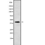CABP1 Polyclonal Antibody