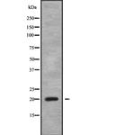 CABP5 Polyclonal Antibody