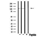 PDE2A Polyclonal Antibody