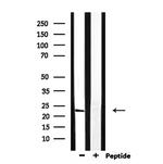 RAB13 Polyclonal Antibody