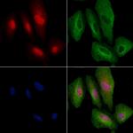 ARHGAP25 Polyclonal Antibody