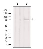 ARHGAP25 Antibody in Western Blot (WB)