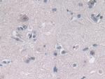 OAS2 Antibody in Immunohistochemistry (Paraffin) (IHC (P))