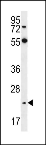 Neurogenin 2 Polyclonal Antibody