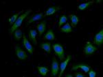AKAP11 Polyclonal Antibody