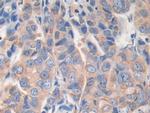 AKAP11 Antibody in Immunohistochemistry (Paraffin) (IHC (P))