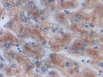 AKAP11 Antibody in Immunohistochemistry (Paraffin) (IHC (P))