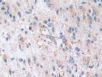 AKAP11 Antibody in Immunohistochemistry (Paraffin) (IHC (P))