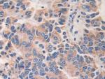AKAP11 Antibody in Immunohistochemistry (Paraffin) (IHC (P))