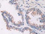 AKAP11 Antibody in Immunohistochemistry (Paraffin) (IHC (P))
