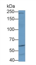 AKAP11 Antibody in Western Blot (WB)