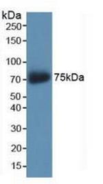 AKAP11 Antibody in Western Blot (WB)