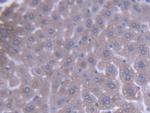 ACAA1 Polyclonal Antibody
