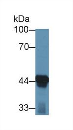 ACAA1 Antibody in Western Blot (WB)