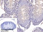 ACP1 Antibody in Immunohistochemistry (Paraffin) (IHC (P))