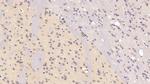 ACP1 Antibody in Immunohistochemistry (Paraffin) (IHC (P))