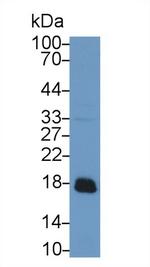ACP1 Antibody in Western Blot (WB)