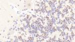 ANP32A Antibody in Immunohistochemistry (Paraffin) (IHC (P))