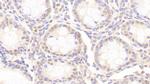 ANP32A Antibody in Immunohistochemistry (Paraffin) (IHC (P))
