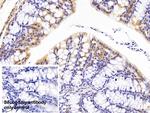 ANP32A Antibody in Immunohistochemistry (Paraffin) (IHC (P))