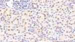 ANP32A Antibody in Immunohistochemistry (Paraffin) (IHC (P))