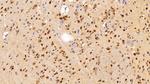 ANP32A Antibody in Immunohistochemistry (Paraffin) (IHC (P))
