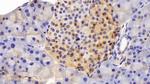 ANP32A Antibody in Immunohistochemistry (Paraffin) (IHC (P))
