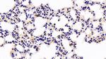ANP32A Antibody in Immunohistochemistry (Paraffin) (IHC (P))