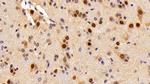 ANP32A Antibody in Immunohistochemistry (Paraffin) (IHC (P))