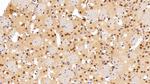 ANP32A Antibody in Immunohistochemistry (Paraffin) (IHC (P))