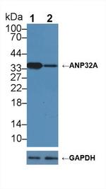 ANP32A Antibody in Western Blot (WB)