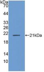 ANP32A Antibody in Western Blot (WB)