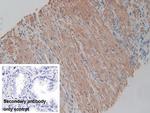 ACTG2 Polyclonal Antibody