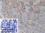ACTG2 Antibody in Immunohistochemistry (Paraffin) (IHC (P))