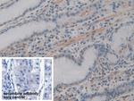 ACTG2 Antibody in Immunohistochemistry (Paraffin) (IHC (P))