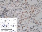 ACTG2 Antibody in Immunohistochemistry (Paraffin) (IHC (P))