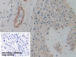 ACTG2 Antibody in Immunohistochemistry (Paraffin) (IHC (P))