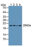 ARPC4 Antibody in Western Blot (WB)