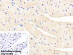 alpha Actinin 2 Polyclonal Antibody
