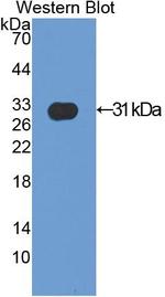 alpha Actinin 2 Antibody in Western Blot (WB)