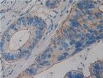 alpha Actinin 4 Polyclonal Antibody