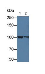 alpha Actinin 4 Antibody in Western Blot (WB)